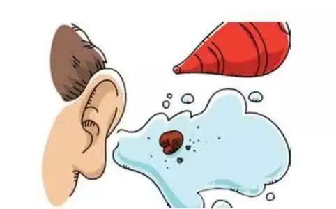 成人怎样软化耳屎呢视频,成人居家护理指南
