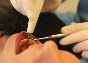 成人自行拔牙视频,揭秘成人自行拔牙全过程